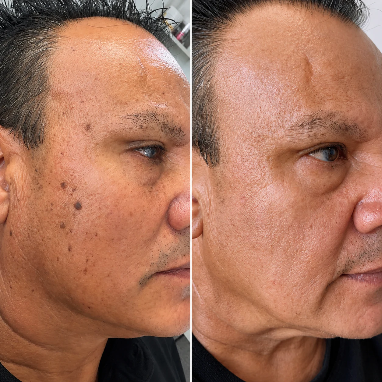 Before and after client result, example five